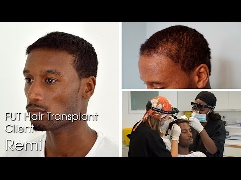 how to transplant skin