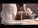 Laser Hair Removal At Michigan Medical Spa Laser Hair Removal At Michigan Medical Spa