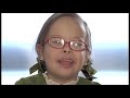 Down syndrome:&nbsp;S�ndrome de Down Madrid