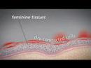 Replens Vaginal dryness