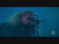 Los Suaves - Maldita sea mi suerte (5) - Radio 3