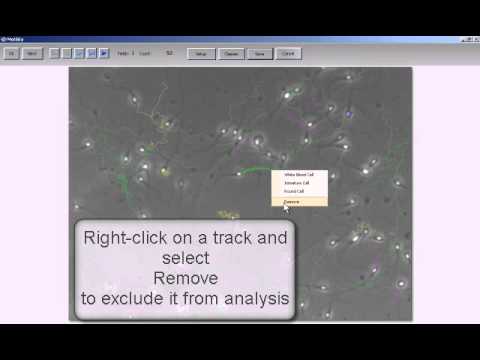 MMC Sperm: sperm motility analysis using phase contrast microscope