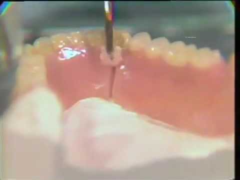 how to repair broken dentures