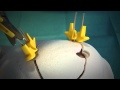 Cranial LOOP - Quick start