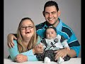 Down syndrome:&nbsp;S�ndrome de Down estudios