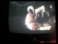 SilentHill: HomeComing Lurker