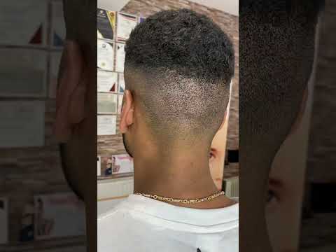 Micropigmentare Scalp 2 - 1