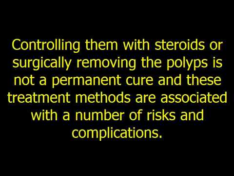 how to cure nasal polyps