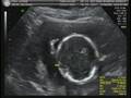 videos de Baby Midkiff 3 of 5