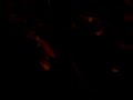 J�j� du roussillon toujours ossi pilo jcroa :p !!
