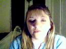 Angelman Syndrome