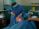 Smartlipo MPX by Dr Ayoubi, the leading Smartlipo Surgeon,UK