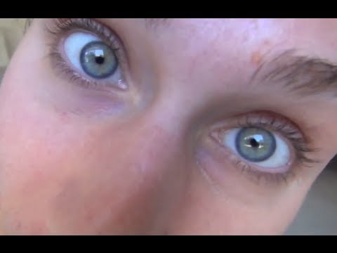 ACNE UPDATE!!!! Summer, Antibiotics, & Water! Acne Journal + What I'm Using + Thoughts:)