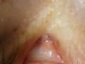 GRjaznooi kliTEr:;