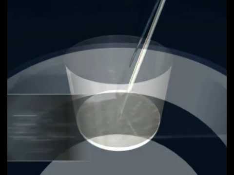 Ver video