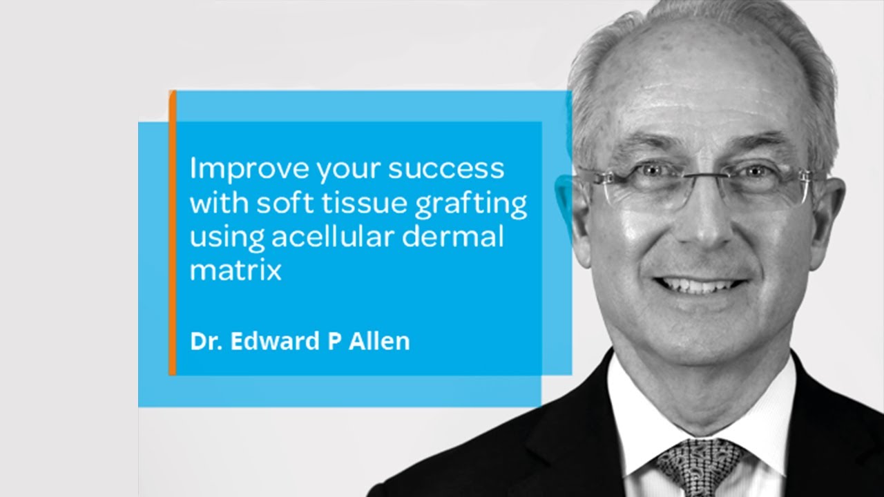 Improve your success with soft tissue grafting using acellular dermal matrix