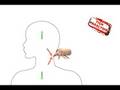 Tick Paralysis (Its Educational)