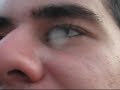 Thumbnail #1