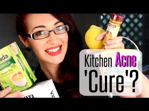 how to cure acne by natural