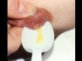 Colostrum: Why do Matt & Angela sell it??? #153