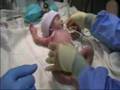 Kocke Triplets