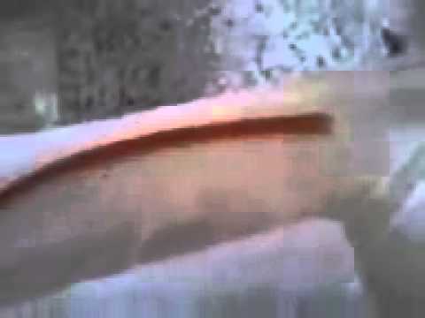 how to cure piles permanently