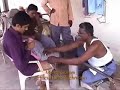 Jamkhed CRHP Artificial Limb Program Artificial Limbs