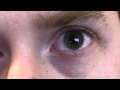 My Left Eye