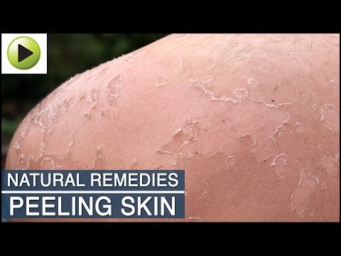 how to stop peeling skin