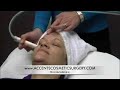 MICRODERMABRASION AT MICHIGAN MEDICAL SPA MICRODERMABRASION AT MICHIGAN MEDICAL SPA