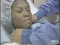 Laser Vaginal Rejuvenation and Designer Laser Vaginoplasty