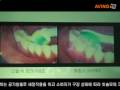 how the sonic care tooth brushes sonic care elite