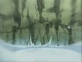 AMV-Naruto-vs-Sasuke