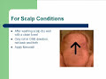 Derma Roller Instructions - How to Use a Dermaroller