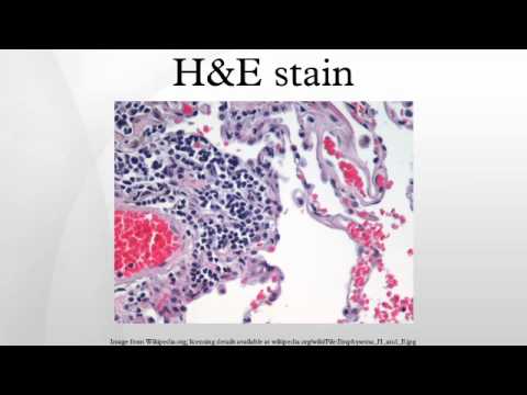 how to perform h&e staining