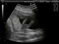 Leilani Ultrasound Leilani Ultrasound