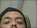 videos de PIERCING SIMULTANEO