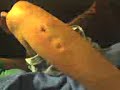 A skin disease u could only catch in Campbelltown! A skin disease u could only catch in Campbelltown!