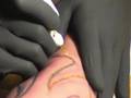 Branding - scarification