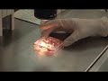 Day 2 (Embryo transfer)