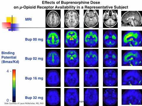 Drug Dependence & The Medical Model
