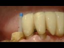 Video_C&Post_eng1.wmv