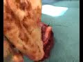 The Cervicofacial Advancement Flap The Cervicofacial Advancement Flap
