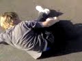 mats broken ankle