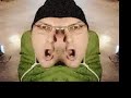 Thumbnail #3