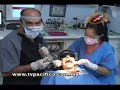 Los Dientes Temporales contienen células madres - Televisora Grupo Pacífico