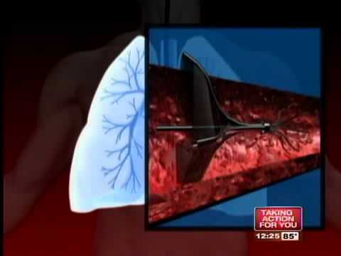how to cure emphysema
