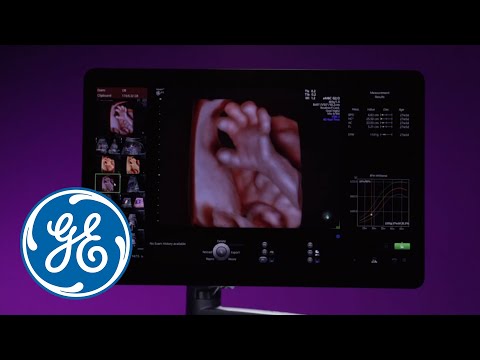 Ultrasound System | Voluson E10