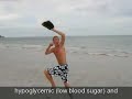 Type 1 Diabetes