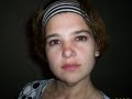 lizzy schultheis argentina bypass gastrico cirugia bariatric